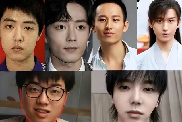 为什么男人也开始热衷整容?...