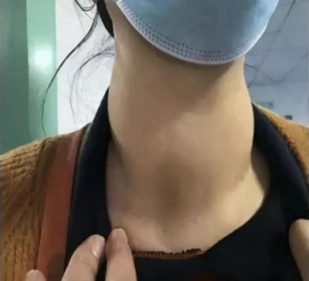 精神不好难道是肚子惹得祸?...