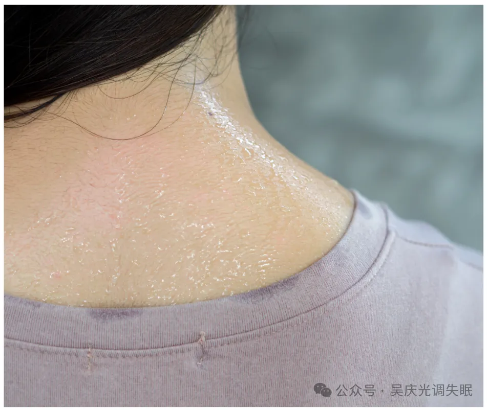 易汗体质是一种怎样的体验?