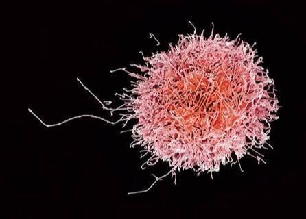 海拉细胞有几种 癌细胞体外存活有多难