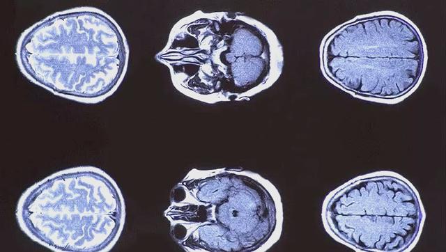 佩雷尔曼为什么拒绝领取破解数学难题的百万美元奖金?...